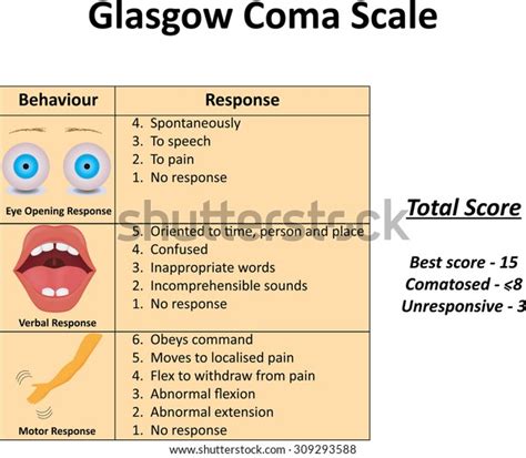 Glasgow Coma Scale Vector De Stock Libre De Regalías 309293588 Shutterstock