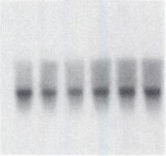 Northern Blot Analyses For Mrna Expressions Of Cyp A And Gst Yc In