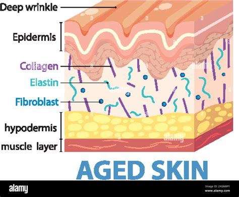 Illustration Showing Layers And Components Of Aged Skin Stock Vector