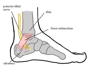 Tarsal Tunnel Syndrome In Pueblo Pueblo West Co Pueblo Ankle And