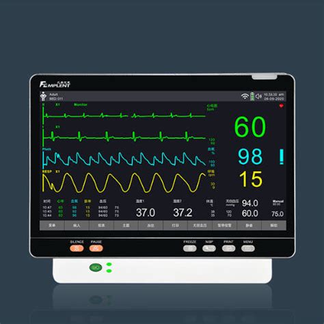 Monitor multiparamétrico compacto Hunan Mplent Optoelectronics