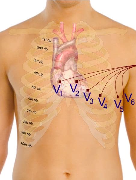 12 Lead ECG Placement Step By Step Guide Lecturio Medical