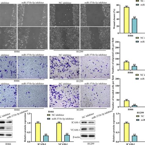 Mir B P Inhibitor Inhibits Migration And Invasion Of Nsclc Cells