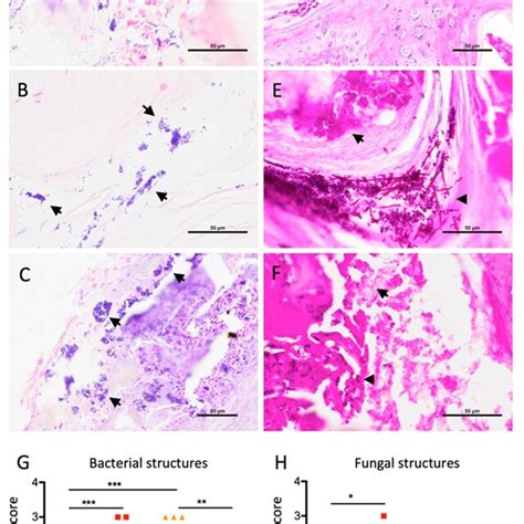 Abundant Microbial Structures Are Prevalent In Actinic Keratosis Ak Download Scientific