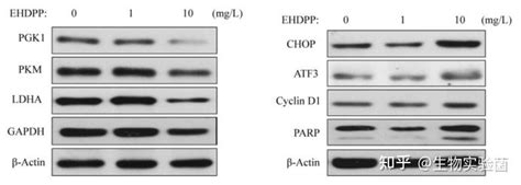 Western Blot 原理及基础应用 知乎