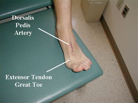 Radiologyspirit Location Of Dorsalis Pedis Artery