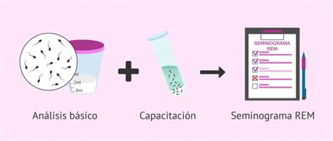 Cu L Es El Precio De Un Seminograma Completo