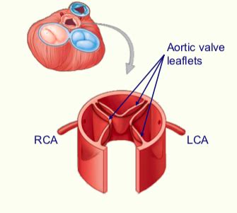 Acute Coronary Syndrome Acs Flashcards Quizlet