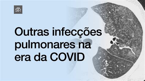 Outras Infec Es Pulmonares Na Era Da Covid Gilberto Szarf Md Youtube