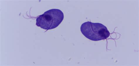 Pathogenic Protozoa Flashcards Quizlet