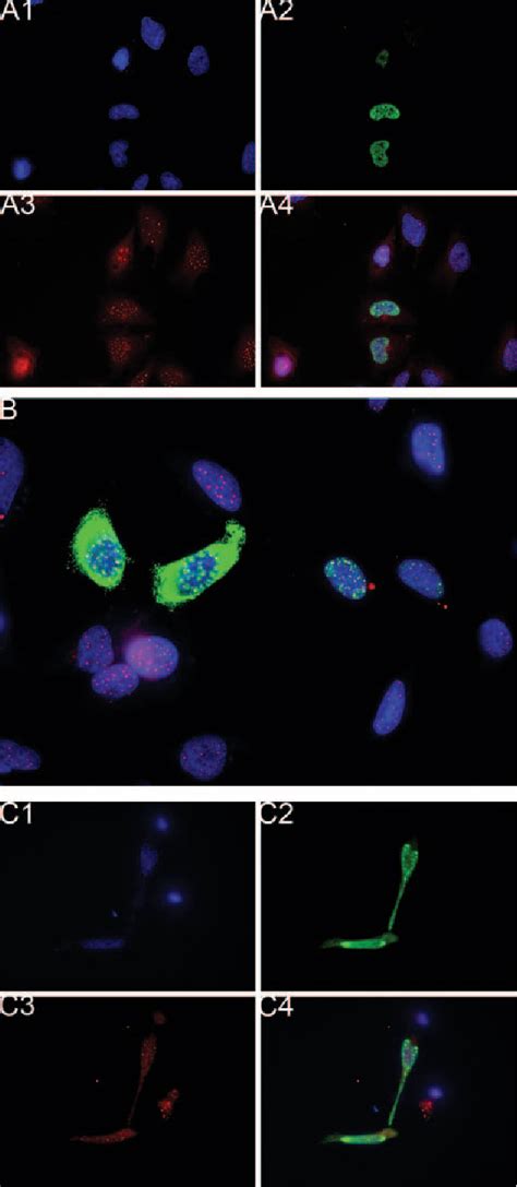 Figure 1 From Immunopathology And Infectious Diseases Expression