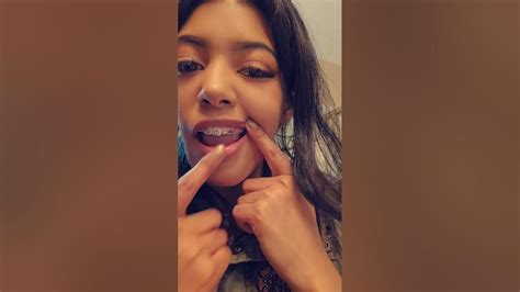 Asmr Teeth Tapping Youtube