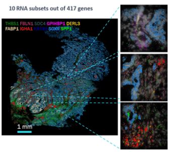 Leading The Global Expansion Of Spatial Transcriptomics Vizgen