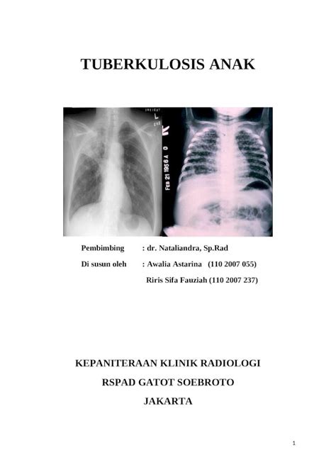 Docx Referat Tuberkulosis Pada Anak Dokumentips