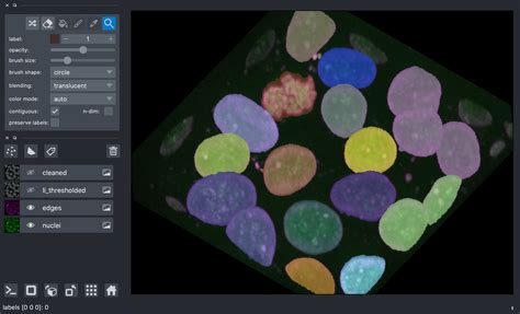 Segmentation — Bioimage Analysis Fundamentals In Python