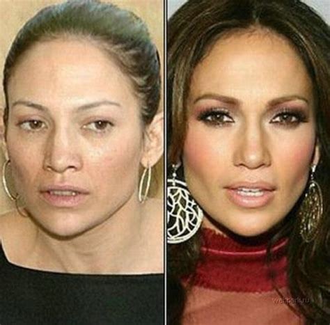 Jennifer Lopez Plastic Surgery Before and After Photos - 2014