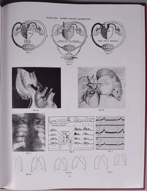 Illustration In Maude Abbott S Atlas In The Footsteps Of Maude Abbott