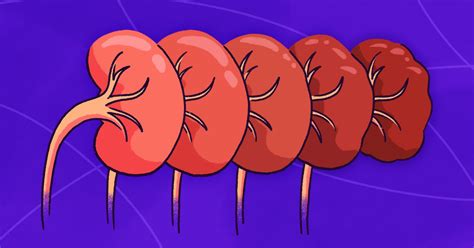 Exploring Chronic Kidney Disease Familiarizing With Its Stages