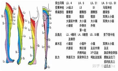 马尾综合征症状到底有哪些 知乎