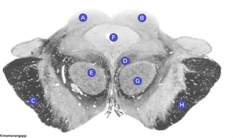 midbrain anatomy Diagram | Quizlet