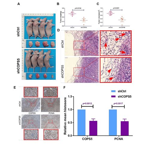 COPS5 Silencing Sensitized Ovarian Cancer To Platinum In Vivo The