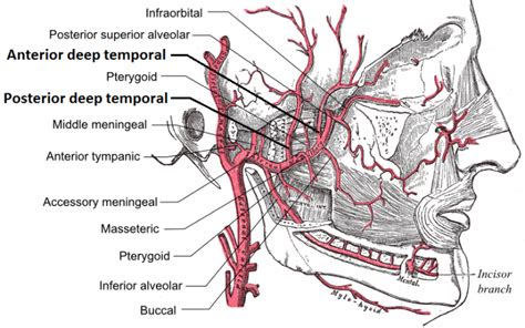 Temporal Arteritis (Giant Cell Arteritis) - Physiopedia