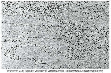 Chromatin Under Microscope