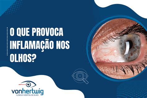 O que provoca Inflamação nos Olhos