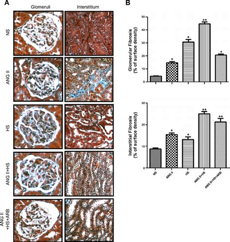 Representative Photomicrographs Of Collagen Deposition Visualized By Download Scientific