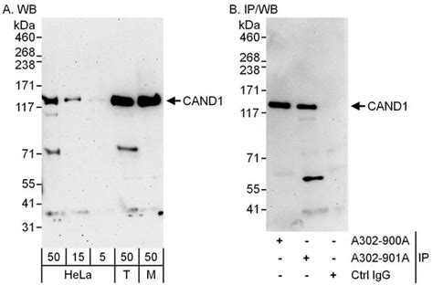 Cand1 Polyclonal Antibody A302 901a