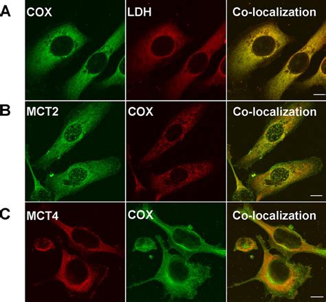 Immunohistochemical Detection Of Mct Ldh Isoforms And Cox In Breast Download Scientific