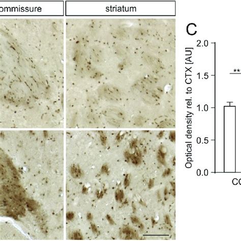 Iron Deposition In White Matter Regions Of Mbp H Syn Mice Images Of