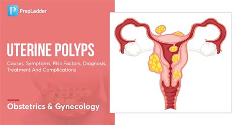 Uterine Polyps Causes Symptoms Risk Factors Diagnosis Treatment