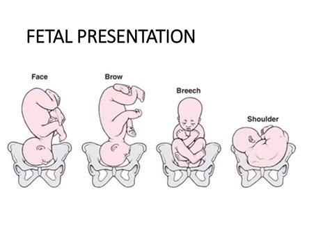 Maternal Pelvis And Fetal Skull Ppt