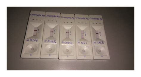 Chlamydia Trachomatis Antigen Test Download Scientific Diagram