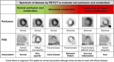 Joint Snmmiasnc Expert Consensus Document On The Role Of F Fdg Pet