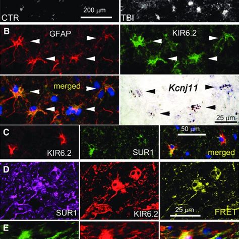 Glial Fibrillary Acidic Protein Gfap Immunoreactivity Dichotomizes