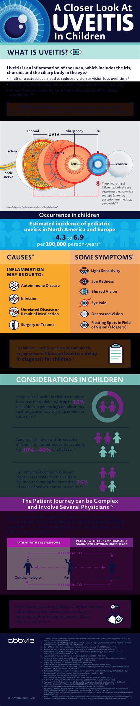Uveitis Rh1 04 Seronegative Spondyloarthropathy At Government