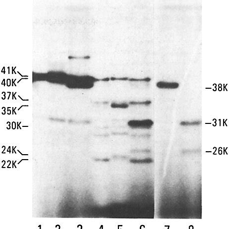 Proteolytic Mapping With S Aureus V Protease Of Cytoplasmic G