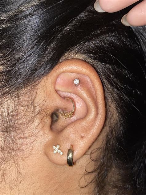 Got My Daith And Flat Done 6 Weeks Ago—second Pic Is When I First Got