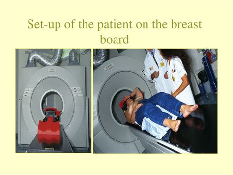 Ppt Post Mastectomy Radiotherapy Powerpoint Presentation Free