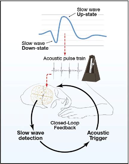 Figure 1 From Reinforcing Rhythms In The Sleeping Brain With A