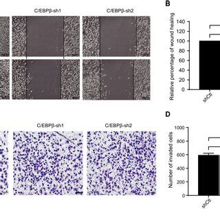 Knockdown of C EBPβ inhibits TNBC cell proliferation and colonyforming