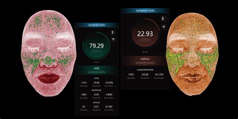 News Isemeco D D Skin Image Analyzer New Product Releaseskin