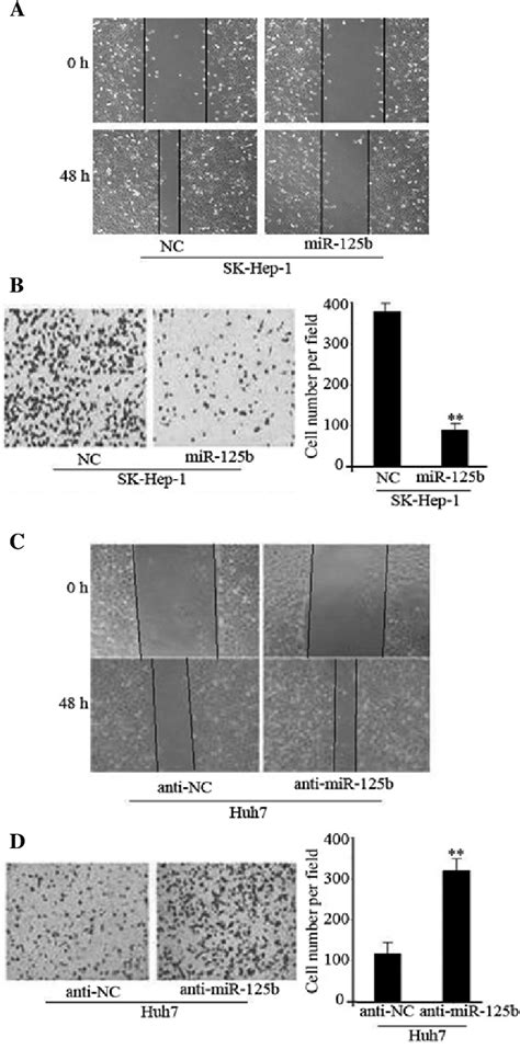 MiR 125b Suppresses HCC Cell Migration And Invasion In Vitro Ectopic