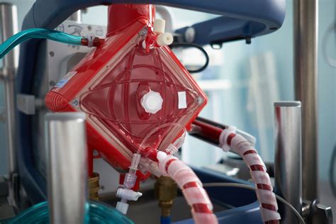 Extracorporeal Membrane Oxygenation In The Emergency Department