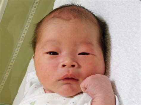 令和4年1月17日 日本海病院産婦人科