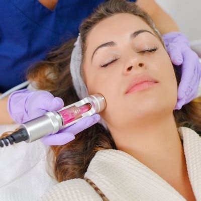 The Pros And Cons Of Laser Acne Therapy What To Consider