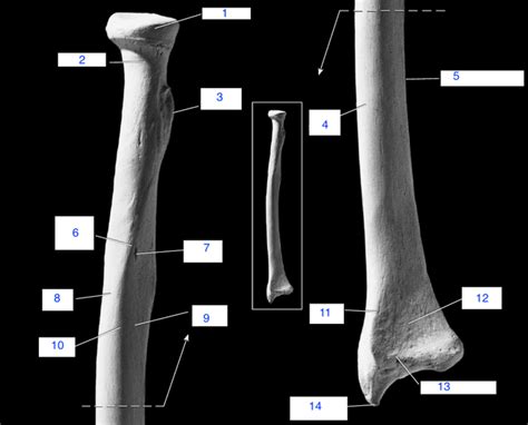 radius anterior copy quiz  ryanspangler