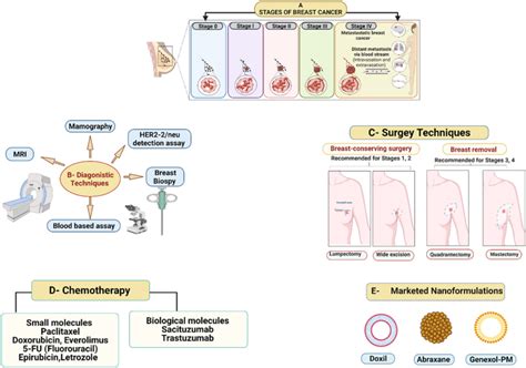 A Different Stages Of Breast Cancer Stage Abnormal Cell Growth